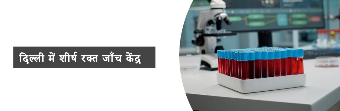 दिल्ली में शीर्ष रक्त जाँच केंद्र